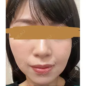 プラチナクリニック口コミ