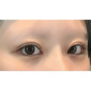 POP美容整形クリニック口コミ