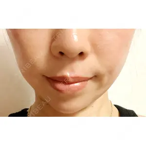 X CLINIC X CLINIC 恵比寿院口コミ