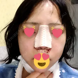 HANABI整形外科口コミ
