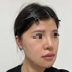 ヒューマン美容外科の