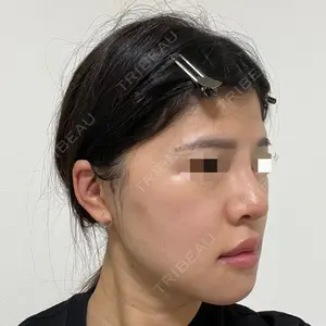 ヒューマン美容外科の