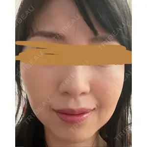 プラチナクリニック口コミ
