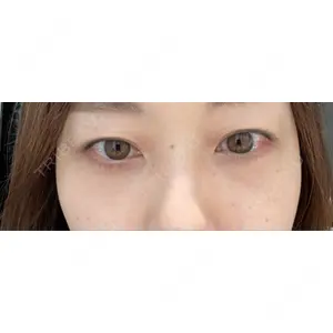 X CLINIC X CLINIC 銀座院口コミ