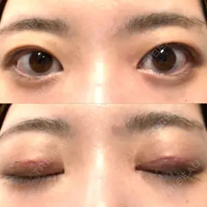 湯田クリニック 銀座口コミ