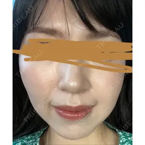 プラチナクリニック口コミ