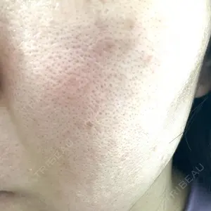 Re:anne clinic 銀座 【リアンクリニック銀座】口コミ
