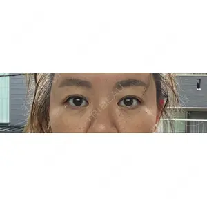 X CLINIC X CLINIC 銀座院口コミ