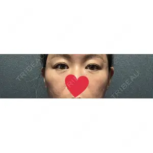 X CLINIC X CLINIC 銀座院口コミ