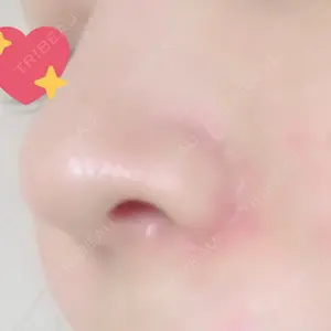 HANABI整形外科口コミ