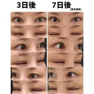 湯田クリニック 銀座口コミ