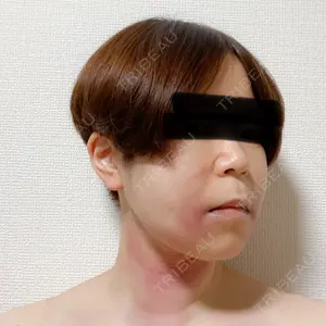 湘南美容クリニック 湘南美容クリニック 秋葉原院口コミ