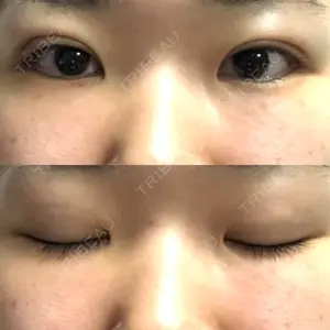 口コミ
