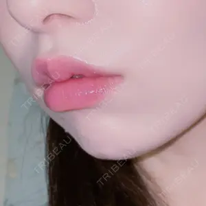 フィラークリニック フィラークリニック 町田院口コミ