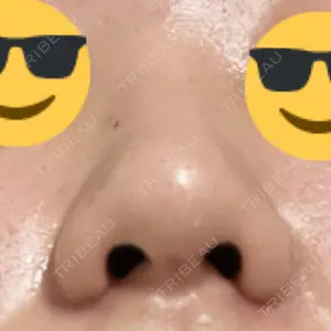 口コミ