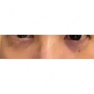 東京イセアクリニック口コミ