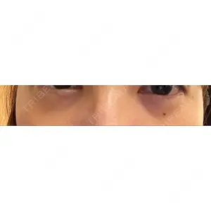 東京イセアクリニック口コミ