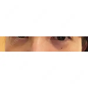 東京イセアクリニック口コミ