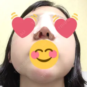HANABI整形外科口コミ