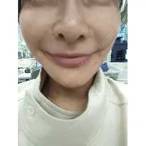 TCB東京中央美容外科 TCB東京中央美容外科 渋谷東口院口コミ
