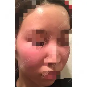 フレッシュ整形外科口コミ