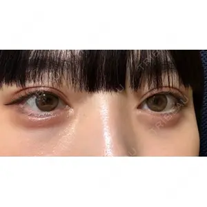 口コミ