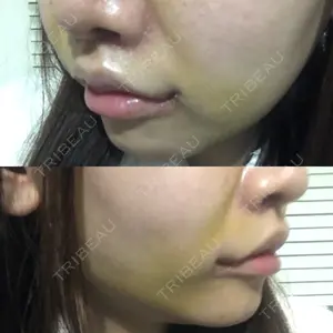 東京皮膚科・形成外科 東京皮膚科・形成外科 (銀座いけだクリニック)口コミ