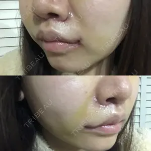 東京皮膚科・形成外科 東京皮膚科・形成外科 (銀座いけだクリニック)口コミ