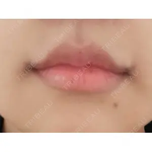 くさのたろうクリニック口コミ