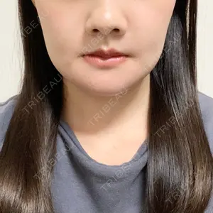 口コミ