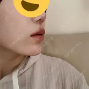 YBC横浜美容外科 YBC横浜美容外科 立川院口コミ