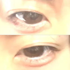 AI Beauty Clinic （エーアイ美容クリニック）口コミ