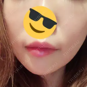湘南美容クリニック 湘南美容クリニック 新宿本院口コミ