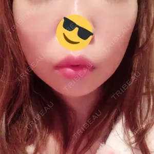 湘南美容クリニック 湘南美容クリニック 新宿本院口コミ