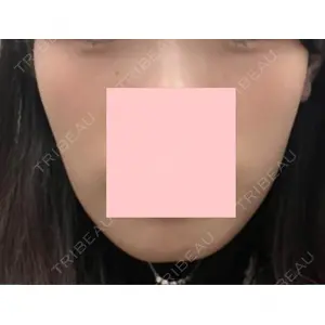 お茶の水美容形成クリニック お茶の水美容形成クリニック口コミ