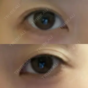 AI Beauty Clinic （エーアイ美容クリニック）口コミ