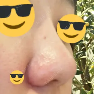 口コミ