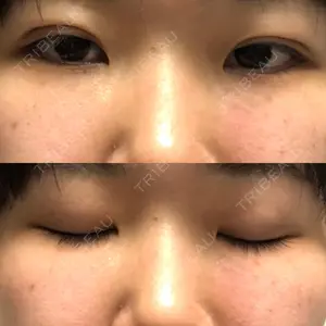 口コミ