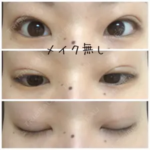 口コミ