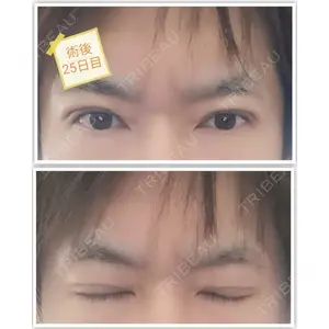 湘南美容クリニック 湘南美容クリニック 宇都宮院口コミ