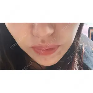 口コミ