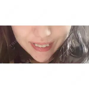 口コミ