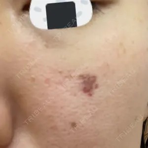 渋谷美容外科クリニック 渋谷美容外科クリニック 横浜院口コミ