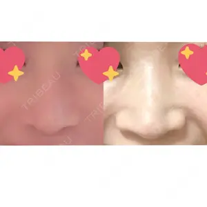 HANABI整形外科口コミ