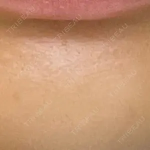 DMTC CLINIC DMTC CLINIC 日本橋院口コミ