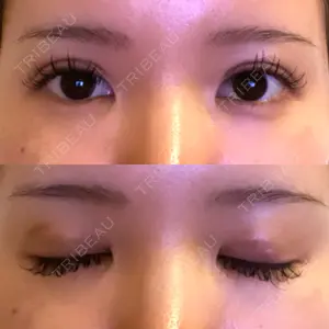 TCB東京中央美容外科 TCB東京中央美容外科 渋谷東口院口コミ