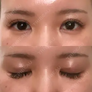 TCB東京中央美容外科 TCB東京中央美容外科 渋谷東口院口コミ