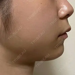 TCB東京中央美容外科 TCB東京中央美容外科 渋谷東口院口コミ