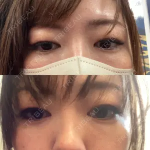 X CLINIC X CLINIC 銀座院口コミ