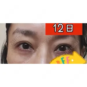 口コミ